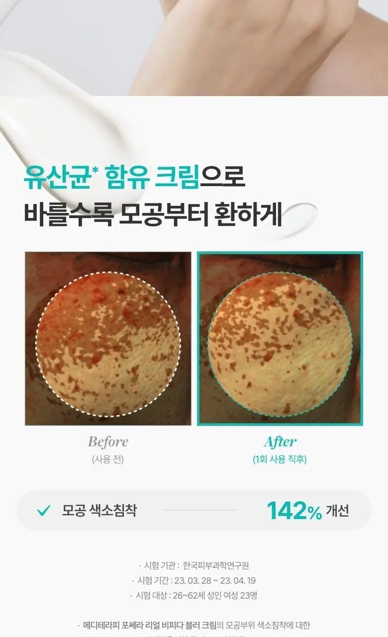 [모공개선/유산균톤업] 메디테라피 포쎄라 리얼 비피다 블러 크림 50ml 증량기획 (+20ml) 상세페이지 4